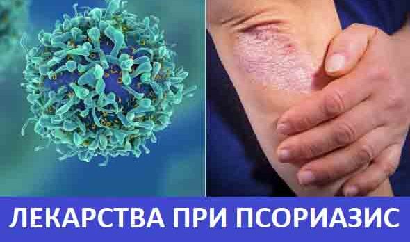 Най-ефикасното лекарство за псориазис: 10+ мнения и идеи 11 Кое е най-ефикасното лекарство за псориазис: Аспирин, Муров мехлем, Кловейт или Дермоват. Хапчета и Yiganerjing крем, мнения. Дайвобет и турски мехлем. Антибиотик.