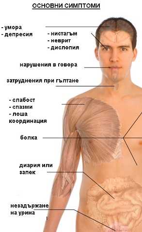 mnojestvena-skleroza-simptomi-1