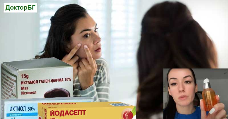 Изтегляне на гной от подкожна пъпка: Йодасепт или Ихтиол, или друго 8 Как се прилага Йодасепт за подкожни пъпки? Антибиотик. Ихтиол. Изтегляне на гной от подкожна пъпка с локум. От твърда пъпка без връх. Роакутан, Акне аут, Фисидин, Даверцин, Зинерит.