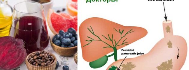 Хранене при прегъната жлъчка: Диета 3 Прегъната жлъчка, хранене и диета