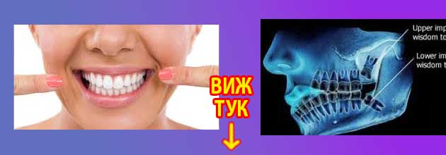 колко зъби има човек 3