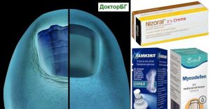 Кое е най-силното лекарство за гъбички по ноктите? От ветеринарната аптека - Антифлегмин. Какво немско лекарство за гъбички по ноктите? Спорил за хора и Миконафин. Орунгал крем.