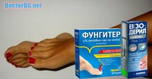 Мнения: Екзодерил или Фунгитер? Лак за нокти против гъбички или крем? Странични ефекти. Ламизил, Батрафен лак, Оникофикс