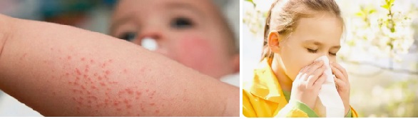 Колко време се пие Ксизал? Мнения. Рупафин и Фортекал по-добри ли са? 4 Ксизал 02