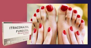 Флуконазол или Итраконазол Фунгизол за гъбички по ноктите? Мнения и коментари. Тербинафин и други заместители на крем и таблетки.