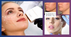 Мнения за хайфу лифтинг. Странични ефекти от HIFU, цени. В домашни условия, какъв апарат да вземем и на каква цена?