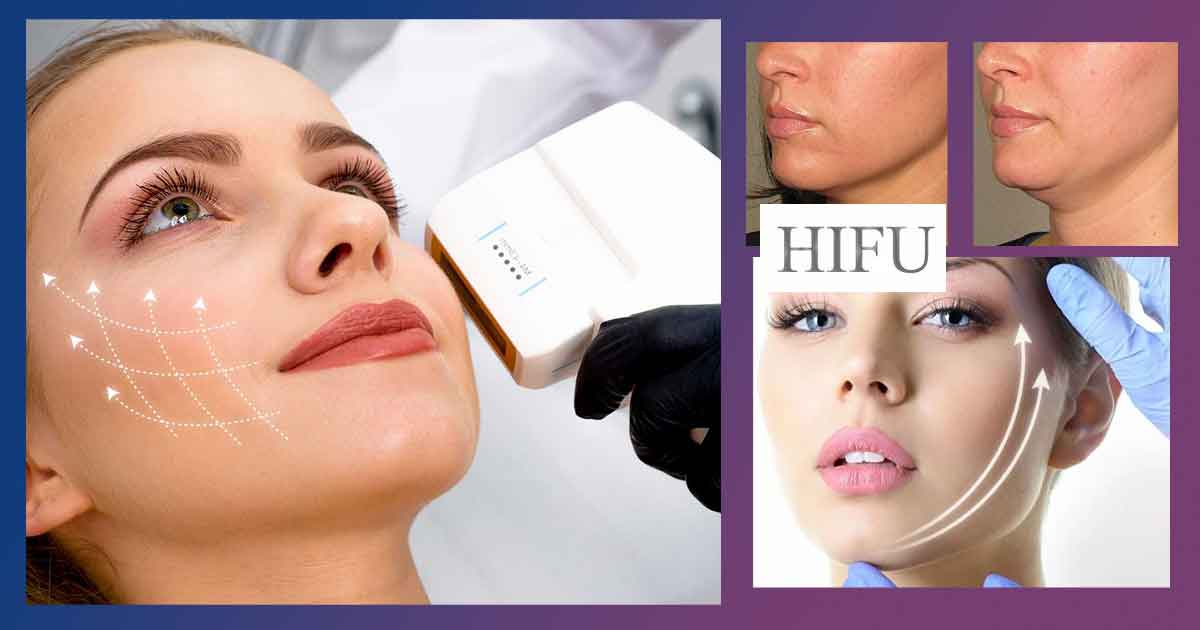 HIFU лифтинг. Мнения и странични ефекти от хайфу 5 Мнения за хайфу лифтинг. Странични ефекти от HIFU, цени. В домашни условия, какъв апарат да вземем и на каква цена?