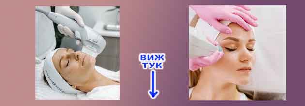 Hifu Lifting Mnenia 03