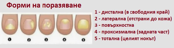 Сода бикарбонат гъбички по ноктите 02