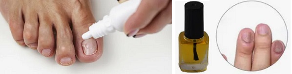 Сода бикарбонат гъбички по ноктите 03