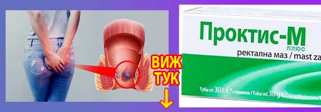 Проктис М Мнения за ректална маз и свещички за хемороиди 2