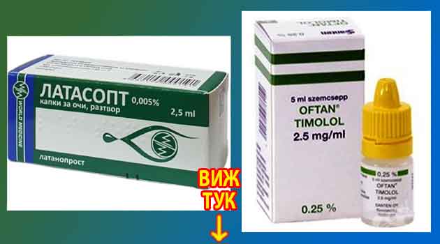 Най-добрите капки за глаукома: Как се излекувах 3 Най добрите капки за глаукома Как се излекувах 3