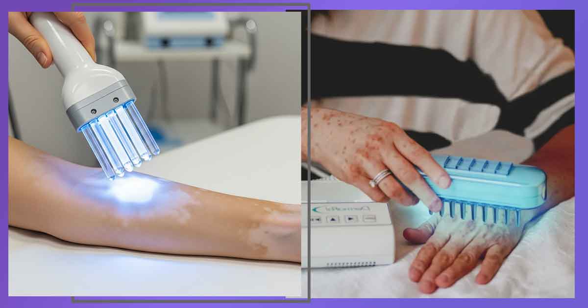 Домашна фототерапия: практическо ръководство за псориазис, акне, гъбички и жълтеница. Как да изберем и какво можем да постигнем.